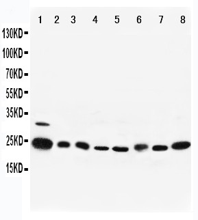 RAB5A / RAB5 Antibody - WB of RAB5A / RAB5 antibody. All lanes: Anti-RAB5A at 0.5ug/ml. Lane 1: Rat Brain Tissue Lysate at 40ug. Lane 2: Rat Ovary Tissue Lysate at 40ug. Lane 3: Human Placenta Tissue Lysate at 40ug. Lane 4: HELA Whole Cell Lysate at 40ug. Lane 5: 293T Whole Cell Lysate at 40ug. Lane 6: A375 Whole Cell Lysate at 40ug. Lane 7: COLO320 Whole Cell Lysate at 40ug. Lane 8: MM453 Whole Cell Lysate at 40ug. Predicted bind size: 24KD. Observed bind size: 24KD.
