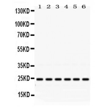 RAB5A / RAB5 Antibody - Rab5 antibody Western blot. All lanes: Anti Rab5 at 0.5 ug/ml. Lane 1: Rat Brain Tissue Lysate at 50 ug. Lane 2: Mouse Brain Tissue Lysate at 50 ug. Lane 3: HELA Whole Cell Lysate at 40 ug. Lane 4: SW620 Whole Cell Lysate at 40 ug. Lane 5: 293T Whole Cell Lysate at 40 ug. Lane 6: JURKAT Whole Cell Lysate at 40 ug. Predicted band size: 24 kD. Observed band size: 24 kD.