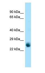 RAB5A / RAB5 Antibody - RAB5A / RAB5 antibody Western Blot of Mouse Pancreas.  This image was taken for the unconjugated form of this product. Other forms have not been tested.