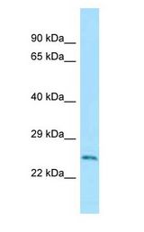 RAB5A / RAB5 Antibody - RAB5A / RAB5 antibody Western Blot of Mouse Small Intestine.  This image was taken for the unconjugated form of this product. Other forms have not been tested.