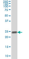 RAB5A / RAB5 Antibody - RAB5A monoclonal antibody (M09A), clone 5D1 Western Blot analysis of RAB5A expression in K-562.