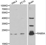 RAB5A / RAB5 Antibody - Western blot of RAB5A pAb in extracts from Hela, PC12 cells and mouse brain tissue.