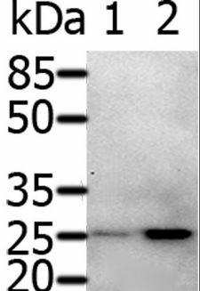 RAB5A / RAB5 Antibody - Western blot analysis of 231 cell and Human fetal brain tissue, using RAB5A Polyclonal Antibody at dilution of 1:600.
