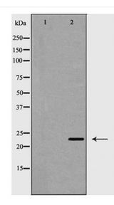 RAB5A / RAB5 Antibody - Western blot of Rab5A expression in HeLa cell lysate