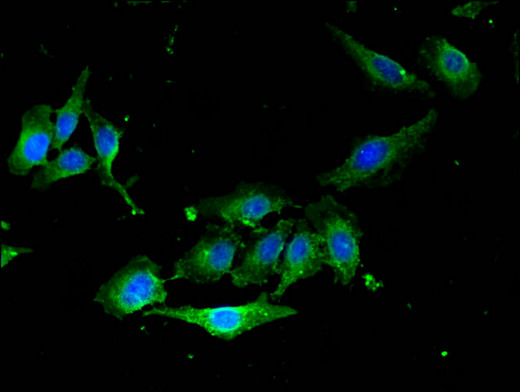 RAB5A / RAB5 Antibody - Immunofluorescent analysis of Hela cells using RAB5A Antibody at a dilution of 1:100 and Alexa Fluor 488-congugated AffiniPure Goat Anti-Rabbit IgG(H+L)