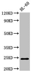 RAB5A / RAB5 Antibody - Western Blot Positive WB detected in: HL60 whole cell lysate All lanes: RAB5A antibody at 2.7µg/ml Secondary Goat polyclonal to rabbit IgG at 1/50000 dilution Predicted band size: 24, 23 kDa Observed band size: 24 kDa