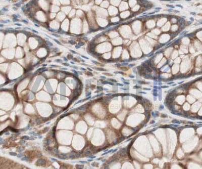RAB5A / RAB5 Antibody - 1/100 staining human colon  tissue by IHC-P. The sample was formaldehyde fixed and a heat mediated antigen retrieval step in citrate buffer was performed. The sample was then blocked and incubated with the antibody for 1.5 hours at 22°C. An HRP conjugated goat anti-rabbit antibody was used as the secondary antibody.