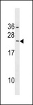 RAB5B Antibody - RAB5B Antibody western blot of HepG2 cell line lysates (35 ug/lane). The RAB5B antibody detected the RAB5B protein (arrow).