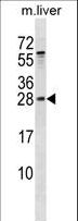 RAB5B Antibody - RAB5B Antibody western blot of mouse liver tissue lysates (35 ug/lane). The RAB5B antibody detected the RAB5B protein (arrow).