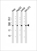 RAB5B Antibody - All lanes: Anti-RAB5B Antibody at 1:2000 dilution. Lane 1: HeLa whole cell lysate. Lane 2: HepG2 whole cell lysate. Lane 3: Jurkat whole cell lysate. Lane 4: NIH-3T3 whole cell lysate Lysates/proteins at 20 ug per lane. Secondary Goat Anti-mouse IgG, (H+L), Peroxidase conjugated at 1:10000 dilution. Predicted band size: 24 kDa. Blocking/Dilution buffer: 5% NFDM/TBST.