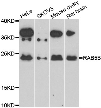 RAB5B Antibody - Western blot analysis of extracts of various cell lines.