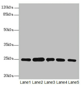RAB5B Antibody - Western blot All Lanes RAB5B antibody at 1.66ug/ml Lane 1 : A431 whole cell lysate Lane 2 : Hela whole cell lysate Lane 3 : Jurkat whole cell lysate Lane 4 : 293T whole cell lysate Lane 5 : HepG-2 whole cell lysate Secondary Goat polyclonal to Rabbit IgG at 1/10000 dilution Predicted band size: 24,20 kDa Observed band size: 24,31 kDa