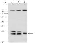 RAB5B Antibody - Anti-RAB5B rabbit polyclonal antibody at 1:500 dilution. Lane A: HeLa Whole Cell Lysate. Lane B: Jurkat Whole Cell Lysate. Lane C: HEK293 Whole Cell Lysate. Lysates/proteins at 30 ug per lane. Secondary: Goat Anti-Rabbit IgG (H+L)/HRP at 1/10000 dilution. Developed using the ECL technique. Performed under reducing conditions. Predicted band size: 23 kDa. Observed band size: 23 kDa.