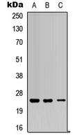 RAB5C Antibody - Western blot analysis of RAB5C expression in SHSY5Y (A); HEK293T (B); NIH3T3 (C) whole cell lysates.
