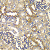 RAB5C Antibody - Immunohistochemistry of paraffin-embedded rat kidney tissue.