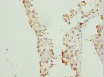 RAB5C Antibody - Immunohistochemistry of paraffin-embedded human testis tissue at dilution 1:100