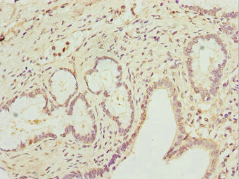 RAB5C Antibody - Immunohistochemistry of paraffin-embedded human pancreatic tissue at dilution 1:100
