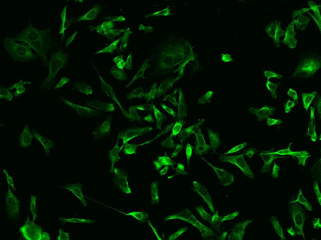 RAB5IF  Antibody - Immunofluorescence staining of C20orf24 in PC3 cells. Cells were fixed with 4% PFA, permeabilzed with 0.1% Triton X-100 in PBS, blocked with 10% serum, and incubated with rabbit anti-Human C20orf24 polyclonal antibody (dilution ratio 1:200) at 4°C overnight. Then cells were stained with the Alexa Fluor 488-conjugated Goat Anti-rabbit IgG secondary antibody (green). Positive staining was localized to Cytoplasm.