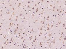 RAB5IF  Antibody - Immunochemical staining of human C20orf24 in human brain with rabbit polyclonal antibody at 1:200 dilution, formalin-fixed paraffin embedded sections.