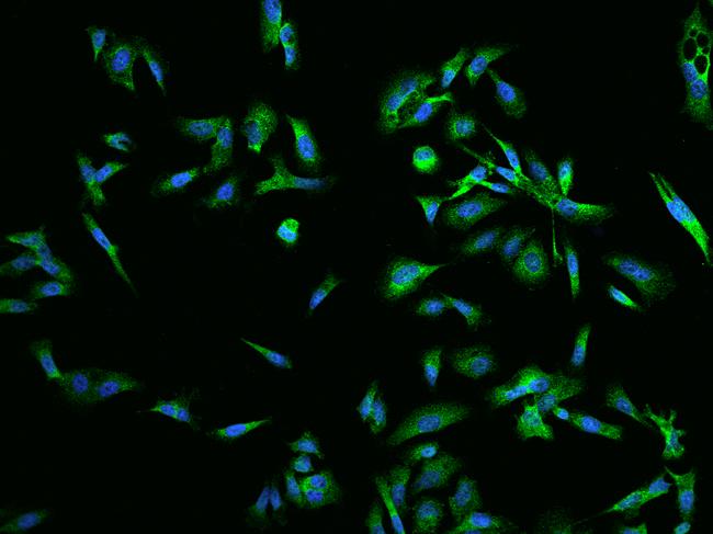 RAB5IF  Antibody - Immunofluorescence staining of C20orf24 in PC3 cells. Cells were fixed with 4% PFA, permeabilzed with 0.1% Triton X-100 in PBS, blocked with 10% serum, and incubated with rabbit anti-Human C20orf24 polyclonal antibody (dilution ratio 1:200) at 4°C overnight. Then cells were stained with the Alexa Fluor 488-conjugated Goat Anti-rabbit IgG secondary antibody (green) and counterstained with DAPI (blue). Positive staining was localized to Cytoplasm.