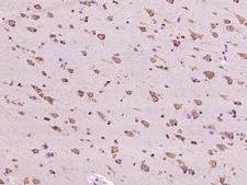 RAB5IF  Antibody - Immunochemical staining of human C20orf24 in human brain with rabbit polyclonal antibody at 1:200 dilution, formalin-fixed paraffin embedded sections.