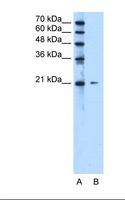 RAB5IF  Antibody - Lane A: Marker. Lane B: Jurkat cell lysate. Antibody concentration: 2.5 ug/ml. Gel concentration: 15%.  This image was taken for the unconjugated form of this product. Other forms have not been tested.