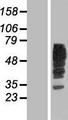 RAB5IF  Protein - Western validation with an anti-DDK antibody * L: Control HEK293 lysate R: Over-expression lysate