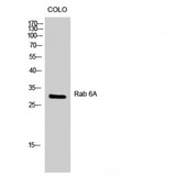 RAB6A / RAB6 Antibody - Western blot of Rab 6A antibody