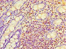 RAB6A / RAB6 Antibody - Immunohistochemistry of paraffin-embedded human rectum tissue using antibody at 1:100 dilution.  This image was taken for the unconjugated form of this product. Other forms have not been tested.