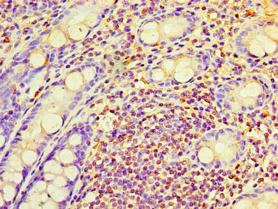 RAB6A / RAB6 Antibody - Immunohistochemistry of paraffin-embedded human rectum tissue using RAB6A Antibody at dilution of 1:100