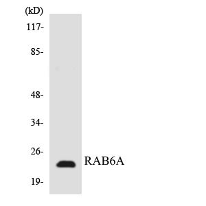 RAB6A / RAB6 Antibody - Western blot analysis of the lysates from HT-29 cells using RAB6A antibody.