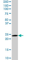 RAB6A / RAB6 Antibody - RAB6A monoclonal antibody (M01), clone 3G3. Western blot of RAB6A expression in PC-12.