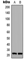 RAB6A / RAB6 Antibody - Western blot analysis of RAB6A expression in COLO205 (A); NIH3T3 (B) whole cell lysates.