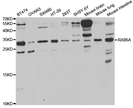 RAB6A / RAB6 Antibody - Western blot analysis of extracts of various cell lines.