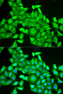 RAB6A / RAB6 Antibody - Immunofluorescence analysis of HeLa cells.