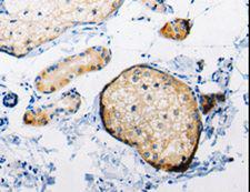 RAB6A / RAB6 Antibody - Immunohistochemistry of paraffin-embedded Human skin using RAB6A Polyclonal Antibody at dilution of 1:25.
