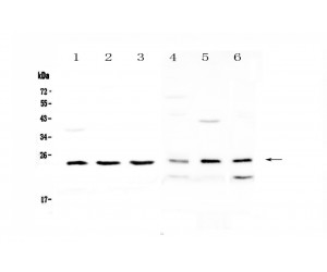 RAB6A / RAB6 Antibody - Western blot analysis of RAB6A using anti-RAB6A antibody