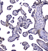 RAB6A / RAB6 Antibody - IHC analysis of RAB6A using anti-RAB6A antibody. RAB6A was detected in paraffin-embedded section of human placenta tissues. Heat mediated antigen retrieval was performed in citrate buffer (pH6, epitope retrieval solution) for 20 mins. The tissue section was blocked with 10% goat serum. The tissue section was then incubated with 2µg/ml rabbit anti-RAB6A Antibody overnight at 4°C. Biotinylated goat anti-rabbit IgG was used as secondary antibody and incubated for 30 minutes at 37°C. The tissue section was developed using Strepavidin-Biotin-Complex (SABC) with DAB as the chromogen.