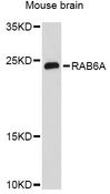 RAB6A / RAB6 Antibody - Western blot analysis of extracts of mouse brain, using RAB6A Antibody at 1:3000 dilution. The secondary antibody used was an HRP Goat Anti-Rabbit IgG (H+L) at 1:10000 dilution. Lysates were loaded 25ug per lane and 3% nonfat dry milk in TBST was used for blocking. An ECL Kit was used for detection and the exposure time was 90s.