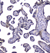 RAB6A / RAB6 Antibody - IHC staining of FFPE human placental tissue with RAB6A antibody at 1ug/ml. HIER: boil tissue sections in pH6, 10mM citrate buffer, for 10-20 min followed by cooling at RT for 20 min.