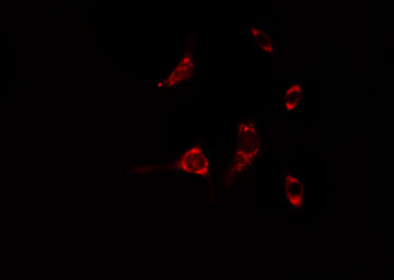 RAB6A / RAB6 Antibody - Staining A549 cells by IF/ICC. The samples were fixed with PFA and permeabilized in 0.1% Triton X-100, then blocked in 10% serum for 45 min at 25°C. The primary antibody was diluted at 1:200 and incubated with the sample for 1 hour at 37°C. An Alexa Fluor 594 conjugated goat anti-rabbit IgG (H+L) antibody, diluted at 1/600, was used as secondary antibody.