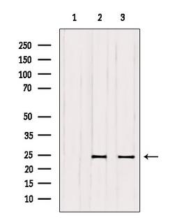 RAB6A / RAB6 Antibody - Western blot analysis of extracts of various samples using RAB6A antibody. Lane 1: HepG2 treated with blocking peptide. Lane 2: HepG2; Lane 3: mouse brain;