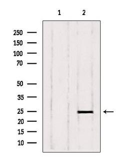 RAB6A / RAB6 Antibody