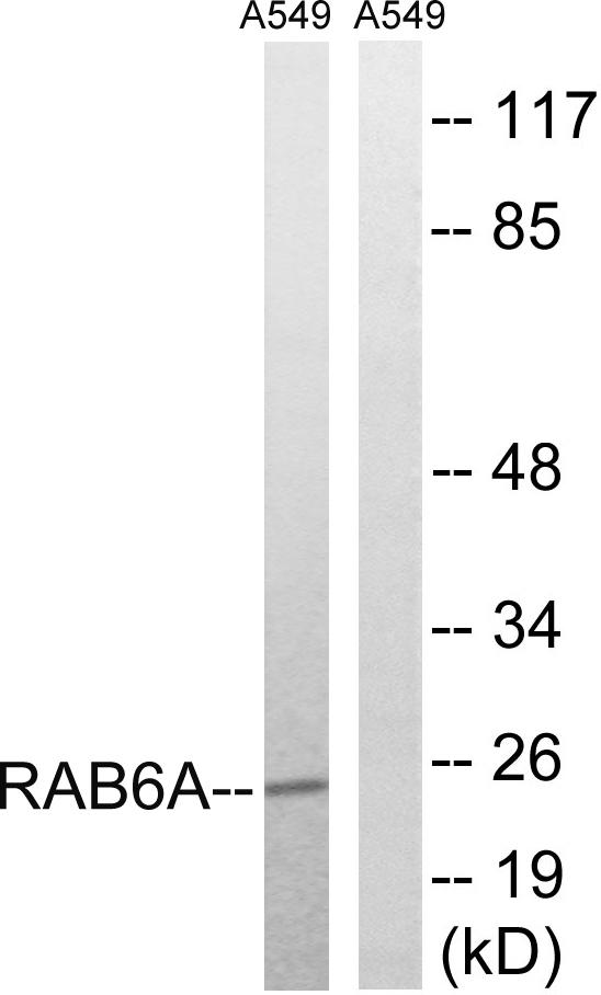 RAB6A / RAB6 Antibody - Western blot analysis of extracts from A549 cells, using RAB6A antibody.