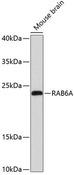 RAB6A / RAB6 Antibody - Western blot analysis of extracts of mouse brain using RAB6A Polyclonal Antibody at dilution of 1:3000.