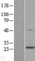 RAB6A / RAB6 Protein - Western validation with an anti-DDK antibody * L: Control HEK293 lysate R: Over-expression lysate