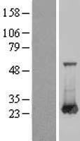 RAB6A / RAB6 Protein - Western validation with an anti-DDK antibody * L: Control HEK293 lysate R: Over-expression lysate