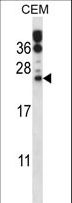 RAB6B Antibody - RAB6B Antibody western blot of CEM cell line lysates (35 ug/lane). The RAB6B antibody detected the RAB6B protein (arrow).