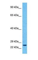 RAB6B Antibody - Western blot of RAB6B Antibody with human HepG2 Whole Cell lysate.  This image was taken for the unconjugated form of this product. Other forms have not been tested.