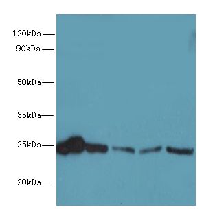 RAB6B Antibody - Western blot. All lanes: RAB6B antibody at 5 ug/ml. Lane 1: Mouse brain tissue. Lane 2: U251 whole cell lysate. Lane 3: MCF7 whole cell lysate. Lane 4: A549 whole cell lysate. Lane 5: K562 whole cell lysate. Secondary antibody: Goat polyclonal to Rabbit IgG at 1:10000 dilution. Predicted band size: 23 kDa. Observed band size: 23 kDa.